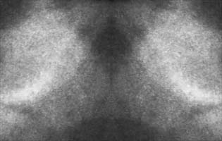 Thumbnail Placeholder